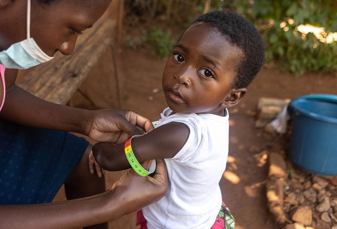 The 2025 Countdown: Africa's Most Affected Nations by Malnutrition 15 The 2025 Countdown: Africa's Most Affected Nations by Malnutrition-
