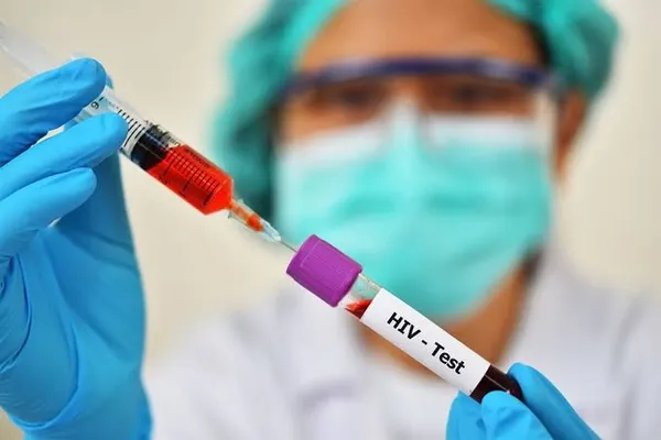 Top 10 African Countries with the Highest Prevalence of HIV/AIDS in 2025